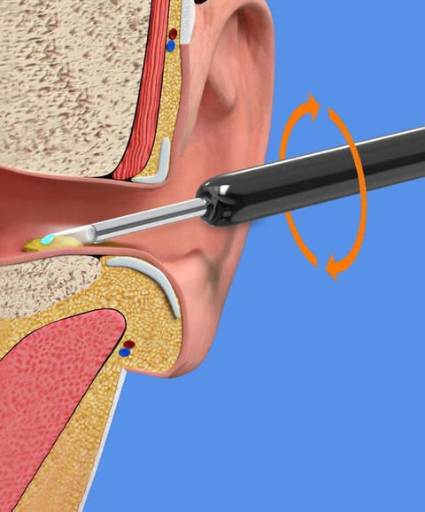 Smart Ear Cleaner with 1296P HD Camera, Wireless Earwax Removal with WiFi Endoscope, Safe Inspection and Intelligent Temperature Control, White