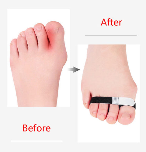 Toe Brace I Toe Bandage I Finger Brace I Finger Bandage I Toe And Finger Corrector I Toe Wrap I 1 Pair I White