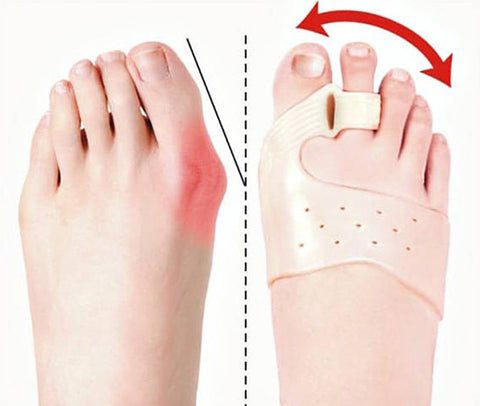 Toe spreader - Bunion toe corrector | bunion - Straighten toe - Bunion