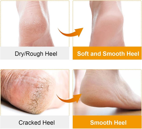 Silicone gel socks | Heel protectors | Heel insoles | Heel cushions | Heel socks | 1 pair | White