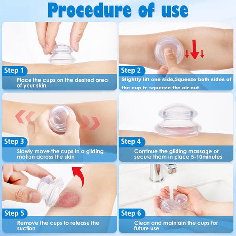 4-piece Cupping cup - Cupping cups - silicone cups - Cupping Set - Cupping For Cellulite - vacuum cup - For reducing cellulite anti-aging relieves pain and joints for buttocks, neck, body - blue