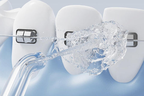 Portable Cordless Water Flosser for Teeth Deep Cleaning