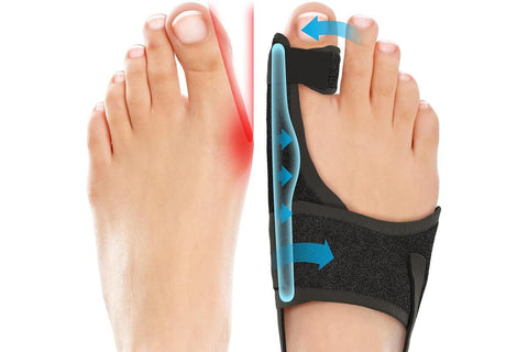 1 Pair Bunion Corrector Adjustable Length Orthopedic Toe Separator for Men and Women