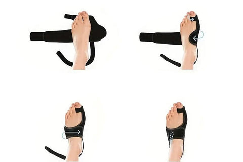1 Pair Bunion Corrector Adjustable Length Orthopedic Toe Separator for Men and Women