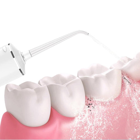 Cordless Water Flosser Teeth Cleaner 300ML Dental Flosser with 4 Jet Tips -White