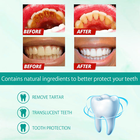 Foam Toothpaste Breath Freshening Whitening Toothpaste Tooth Anti-Moth Mouth Cleaning Tooth Stains And Gum Care