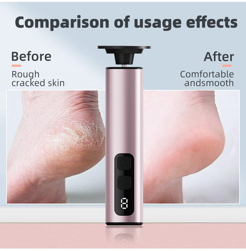 Rose Gold Professional 2-in-1 Electric Foot Callus Remover and Manicure Kit - 9 Speeds Rechargeable Electronic Foot File with LCD Display - Professional Pedicure Tool for Dead Skin and Nail Care