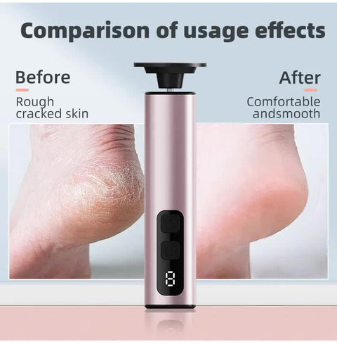 Purple Rechargeable Electric Foot File with 9 Speed Settings - Callus Remover for Smooth Feet